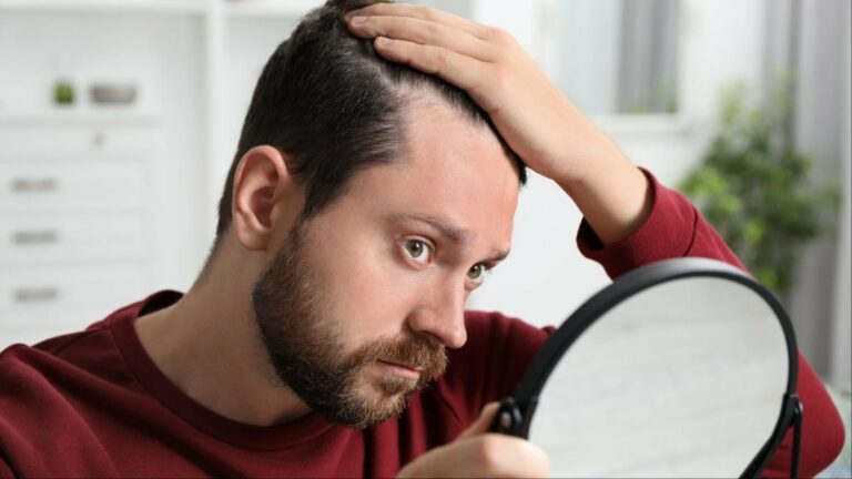 Bald Patches? Try These 4 Ingredients With Mustard Oil for Fast Regrowth | Lifestyle News